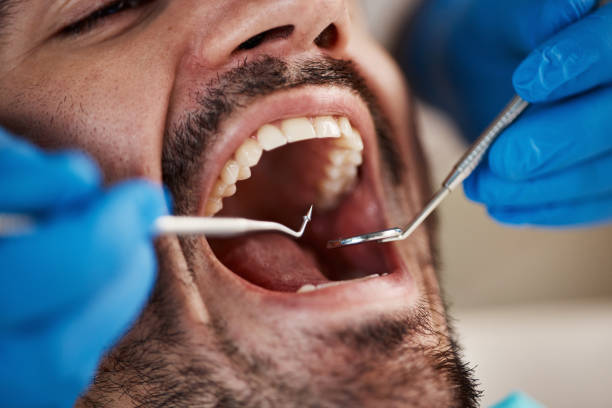 Best Broken or Chipped Tooth Repair in Twain Harte, CA
